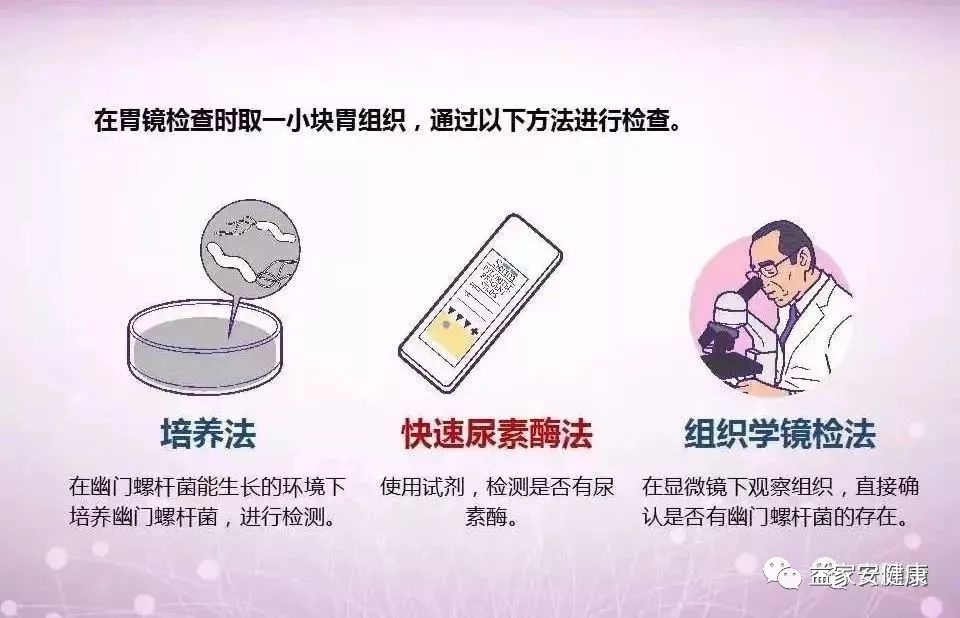 胃镜活检检查HP