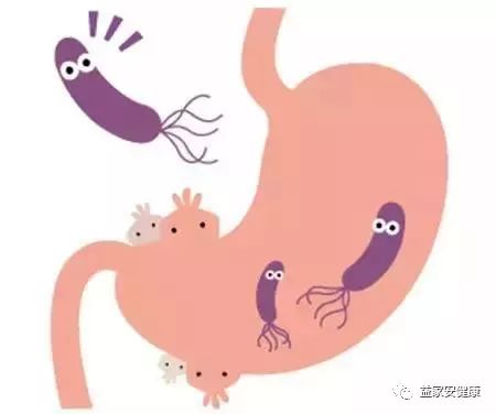 什么是幽门螺杆菌